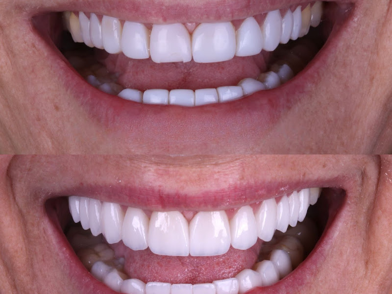 Foto 2 de Oralestetica-Clinica Odontologica