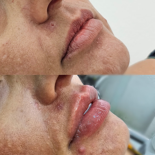 Foto 2 de OralFace Odontologia e Harmonização Facial