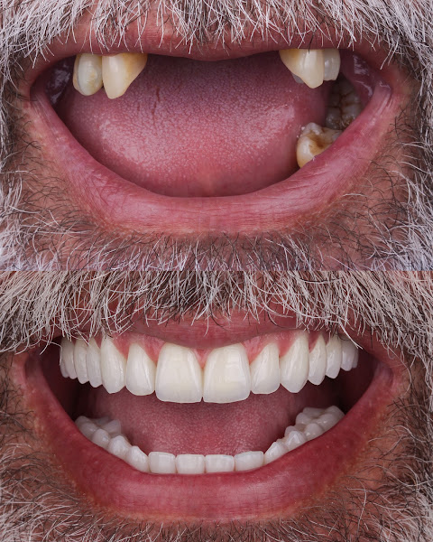 Foto 2 de Oralfy Belém | Implante | Invisalign | Dentista em Belém