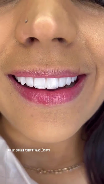 Foto 3 de Oralfy Dentista em Atibaia