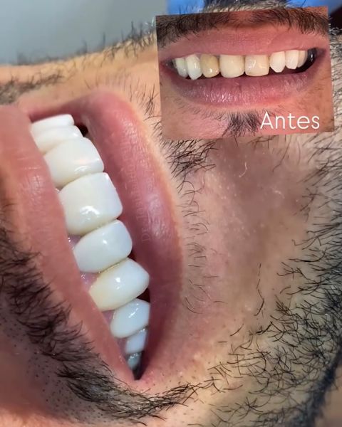 Foto 3 de Oralife Consultório Odontológico - Dentista em João Pessoa
