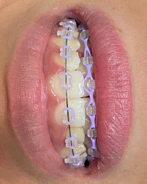 Foto 5 de Oralife Consultório Odontológico - Dentista em João Pessoa