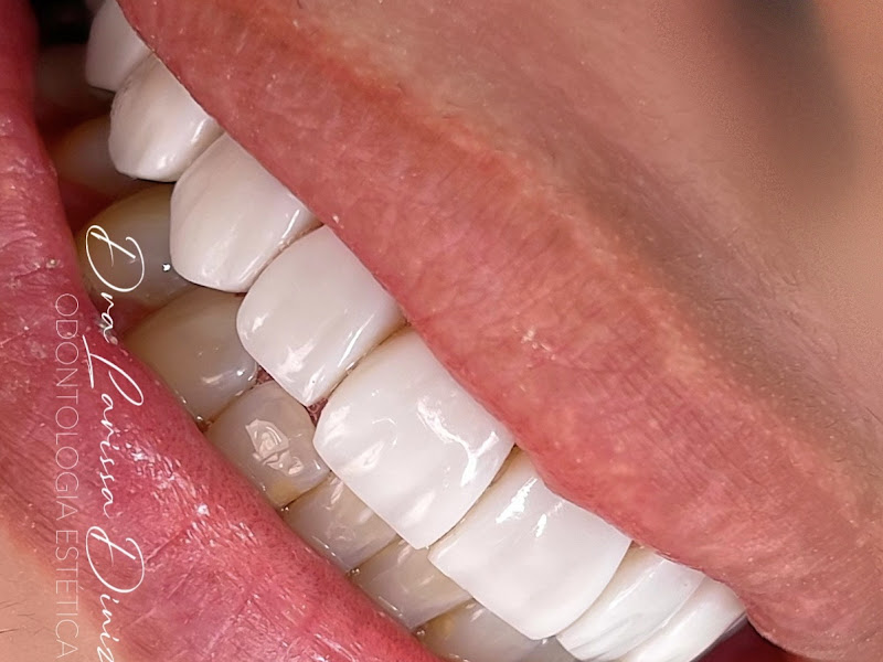 Foto 8 de Oralife Consultório Odontológico - Dentista em João Pessoa