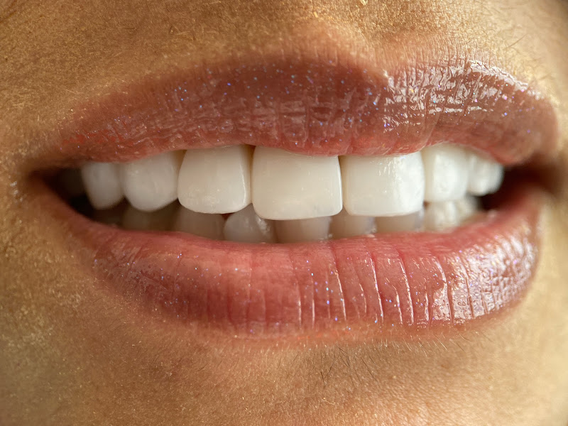 Foto 12 de Oralife Consultório Odontológico - Dentista em João Pessoa