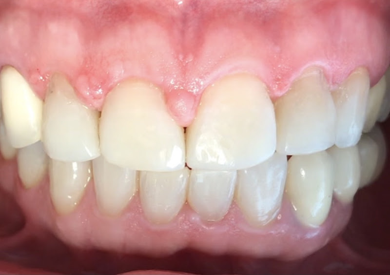 Foto 2 de Oralis Odontologia / Dra. Tatiana Veríssimo Pinheiro