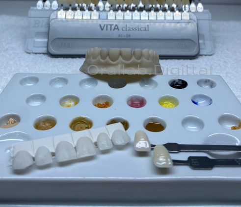Foto 2 de Orallab.Digittal Laboratório de Prótese Dentária