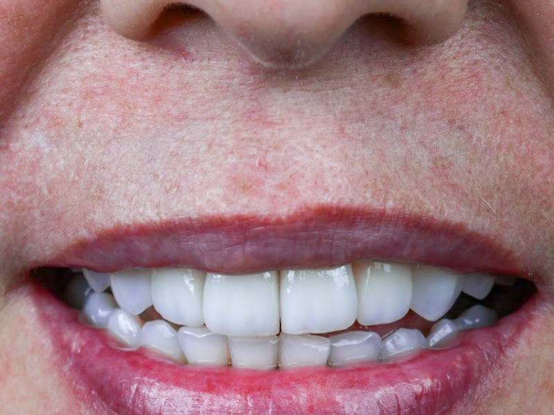 Foto 8 de Oralle Odontologia Estética e Funcional