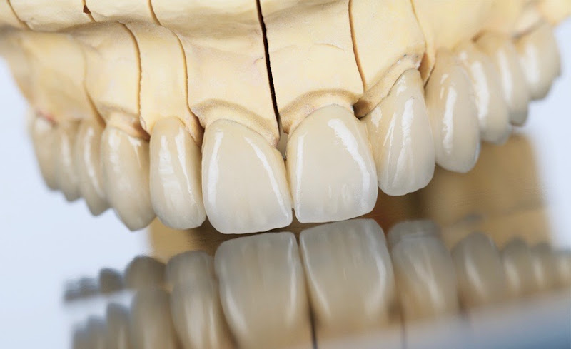 Foto 3 de Orallux - Odontologia Especializada