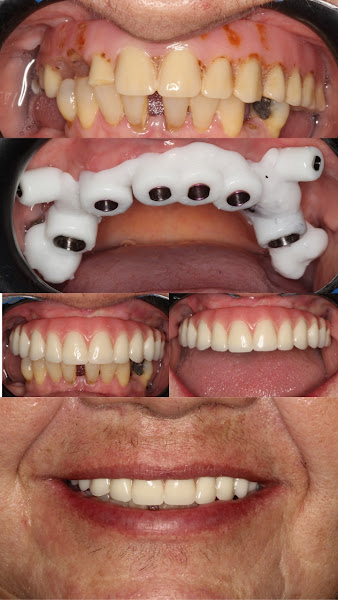 Foto 2 de OralSPDente