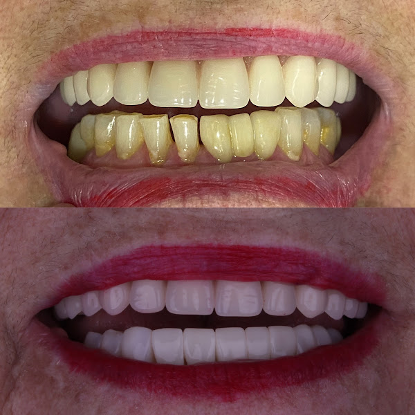 Foto 2 de Orgulho de Sorrir