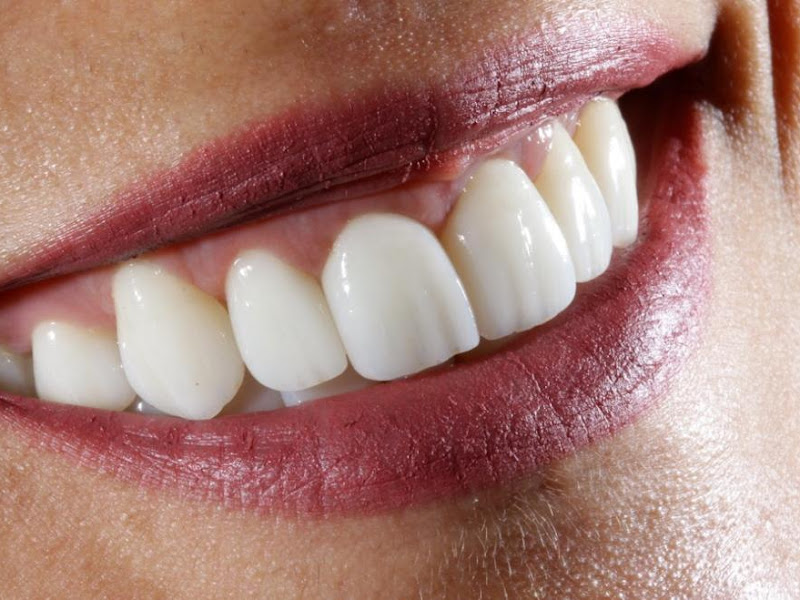 Foto de Oro Odontologia