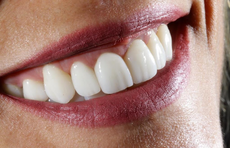 Foto 2 de Oro Odontologia