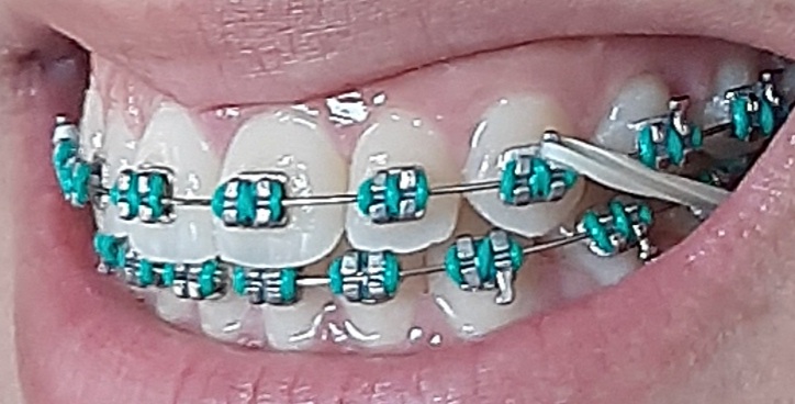 Foto 3 de Oro Odontologia Avançada