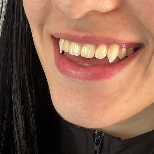 Foto 2 de OROFACIAL AGENCY - Fangs Dentais Brasil