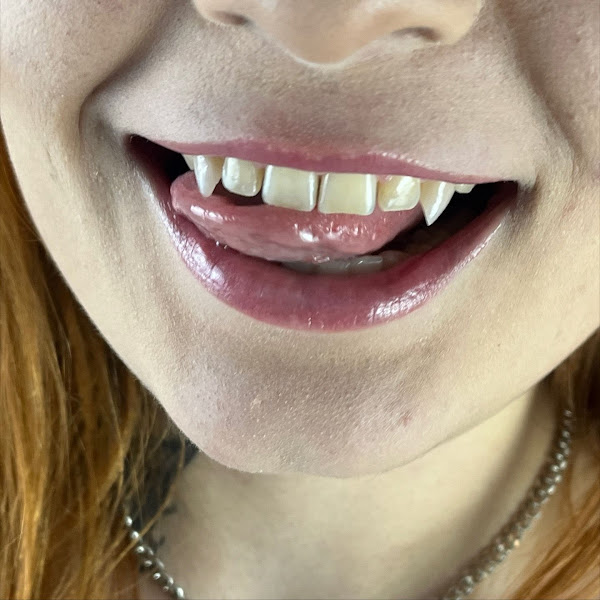 Foto 3 de OROFACIAL AGENCY - Fangs Dentais Brasil