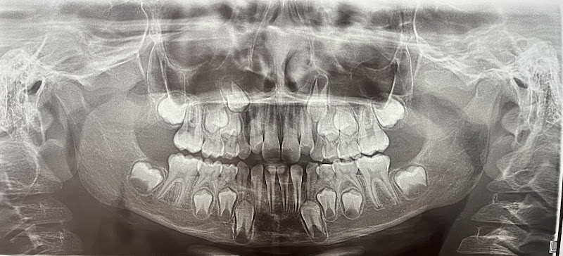 Foto 3 de Ortho-X Rudge Ramos