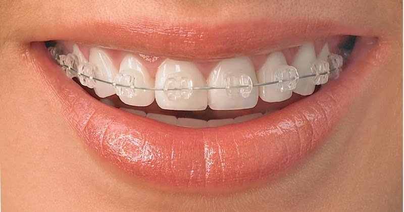 Foto 2 de ORTHOLIP - Clínica Odontológica