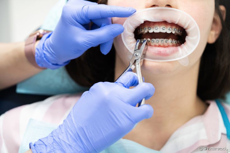 Foto 2 de Ortholovers - Ortodontia & Estética Facial Especializadas ME