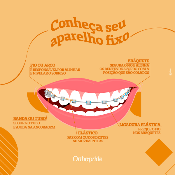 Foto 3 de Orthopride Itaquera