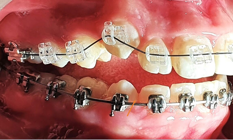 Foto 3 de OrthoPride Salvador