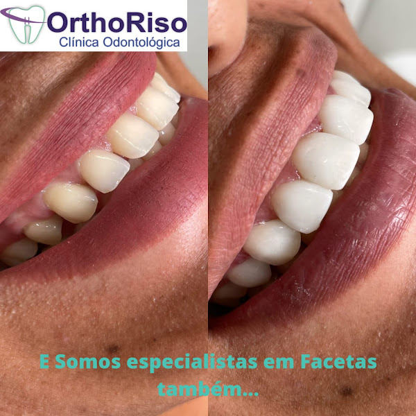 Foto 3 de Orthoriso Avenida Sete - Centro