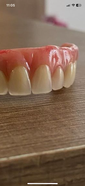 Foto 2 de Orthovipi Implantes