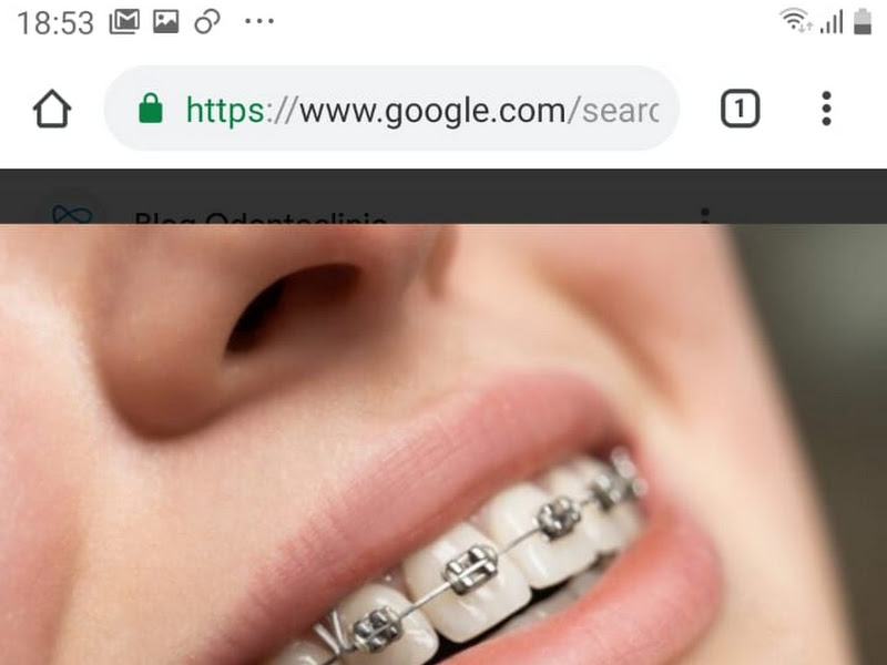 Foto 9 de ORTIS - Tratamentos Odontológicos