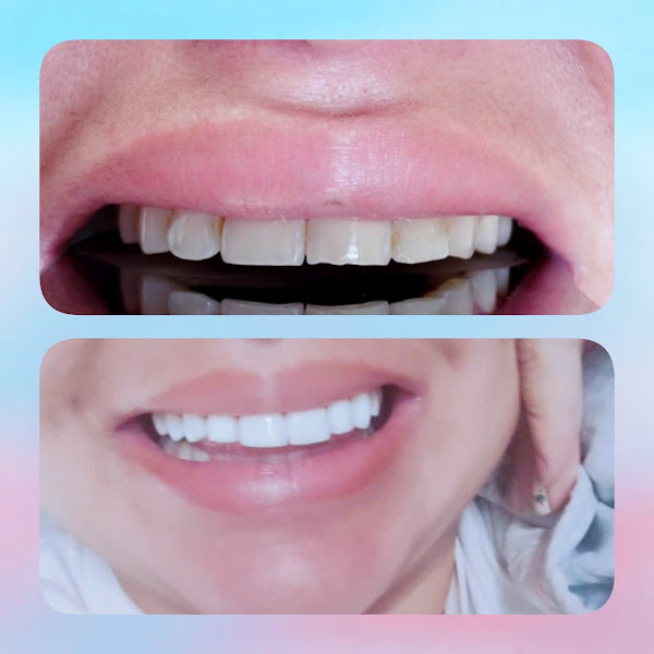 Foto 2 de Orto e Implante Belém