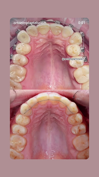 Foto 3 de Orto e Implante Belém