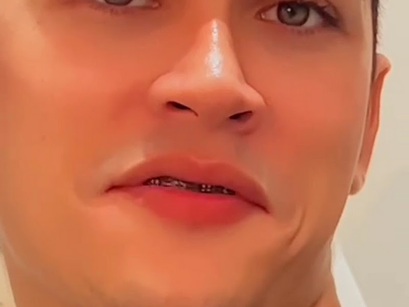 Foto 3 de Orto Império - Odontologia Especializada