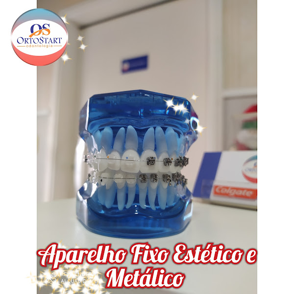 Foto 3 de Orto Start Odontologia | Ortodontia, Implante Dentário & Clareamento Dental | Santo André - SP