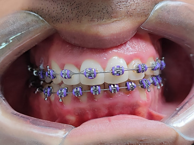 Foto 8 de Orto Start Odontologia | Ortodontia, Implante Dentário & Clareamento Dental | Santo André - SP