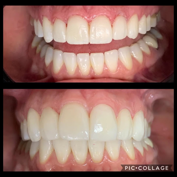 Foto 2 de OrtoBr Clínica de Ortodontia - Dr Edmilson Brasil dos Santos