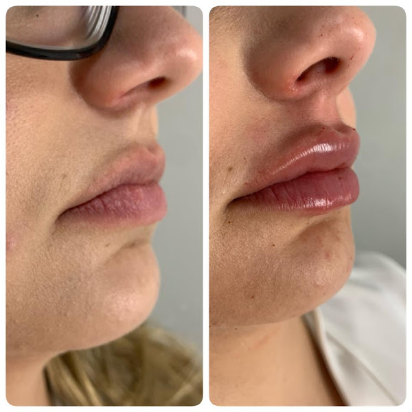 Foto 3 de Ortocanal Consultorio Odontologico