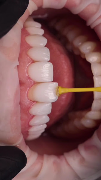 Foto 3 de Ortocenter - Clínica Odontológica - Ipatinga