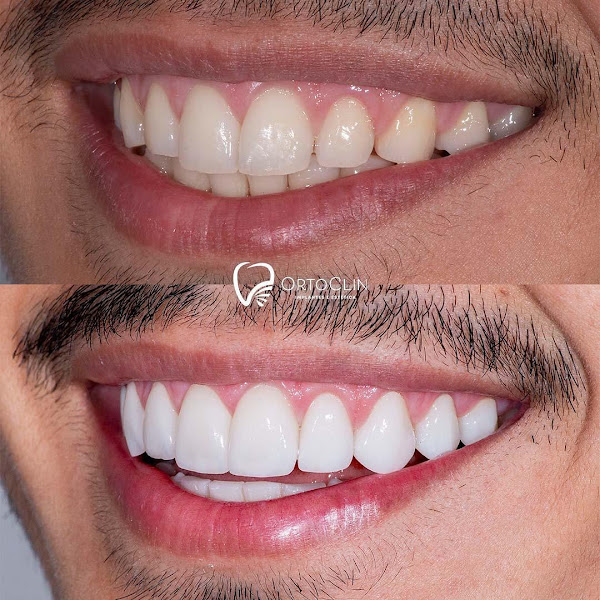 Foto 2 de Ortoclin Apucarana