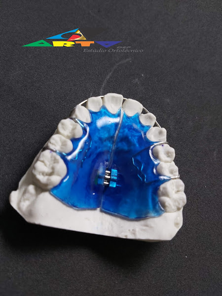 Foto 3 de OrtoDep Estúdio Ortotécnico