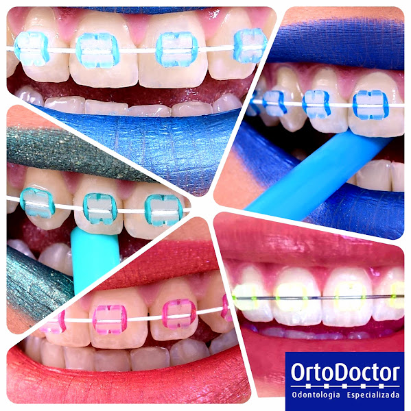 Foto 3 de Ortodoctor Goiânia - unid Vila Brasília