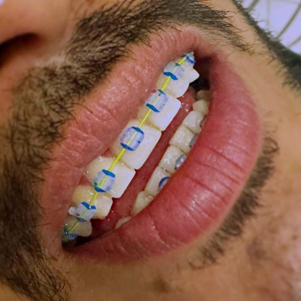 Foto 2 de Ortodoctor Rondonópolis