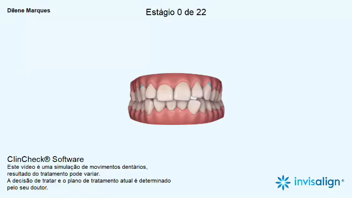 Foto 4 de Ortodontia Dra. Dilene Marques