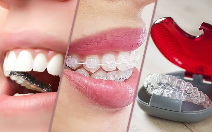 Foto 2 de Ortodontia e Clínica Pulitini