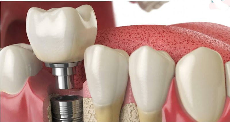 Foto 2 de Ortodontia & Implantodontia