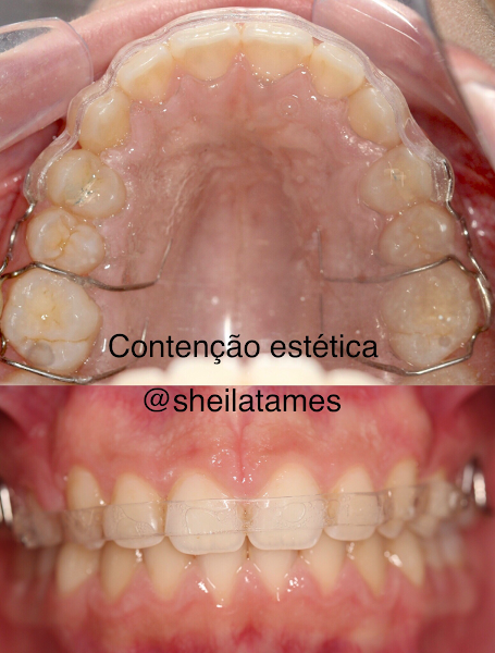 Foto 3 de Ortodontia Sheila Foppa A. Tames Jurerê
