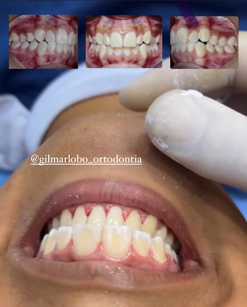 Foto 2 de Ortodontista - Cirurgião Dentista / Dr. Gilmar Lobo