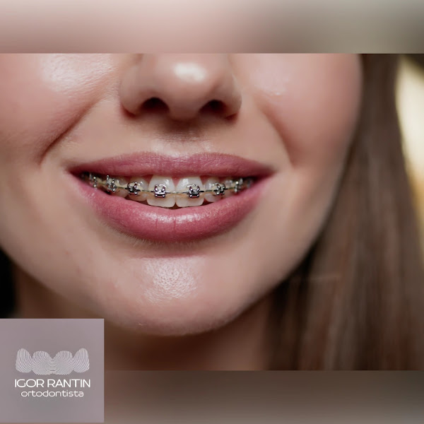 Foto 3 de Ortodontista Dr. Igor Rantin - São Carlos