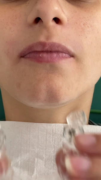 Foto 3 de Ortodontista Dr. Olegario Bastos