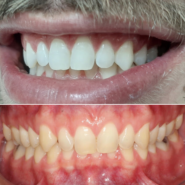 Foto 2 de Ortodontista Dr. Rogerio Mendes - Ortodontia, Implante e Estética