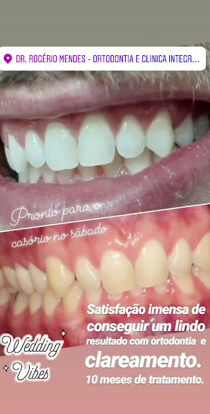 Foto 3 de Ortodontista Dr. Rogerio Mendes - Ortodontia, Implante e Estética