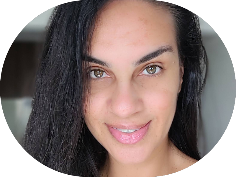 Foto 5 de Ortodontista em Recife Dra. Carolina Angelo | Dentista | Aparelho Ortodôntico | Tratamento Ortocirurgico