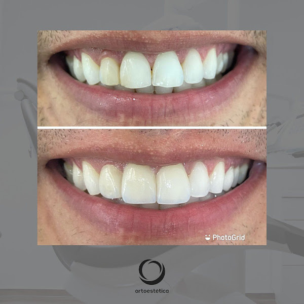 Foto 3 de Ortoestética Águas Claras